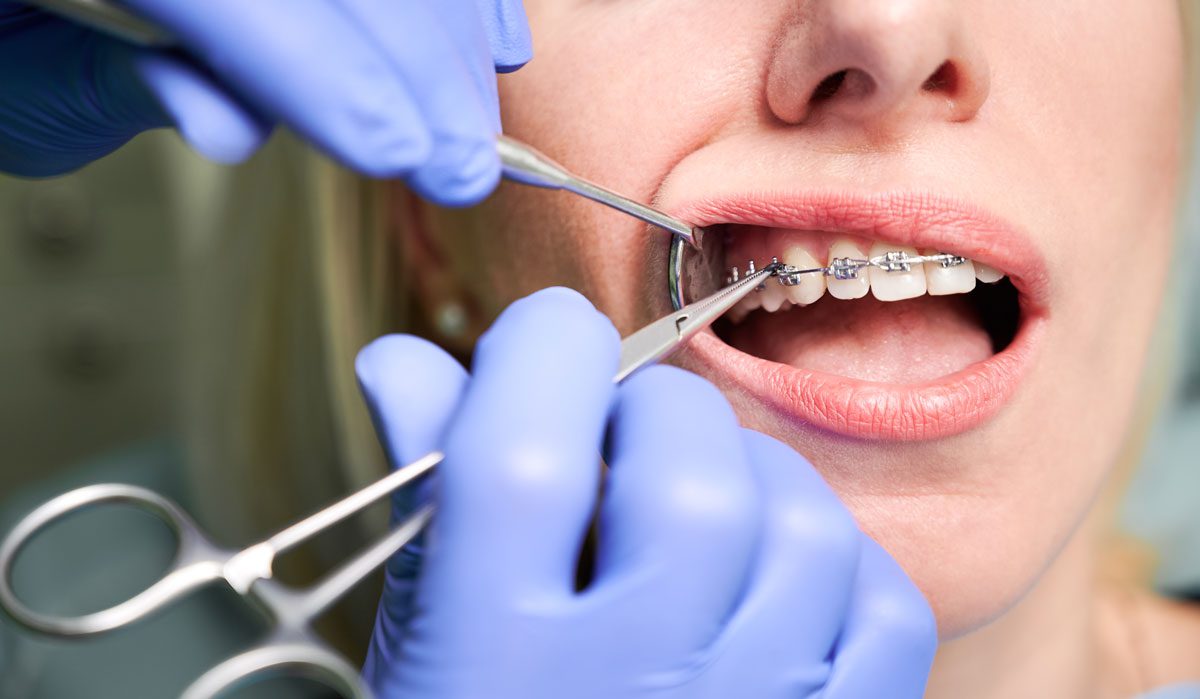 Is Orthodontics Cosmetic Dentistry - Golden Gate Dentists