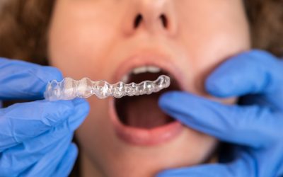 Can You Go to an Orthodontist Without a Referral? Expert Insights Revealed