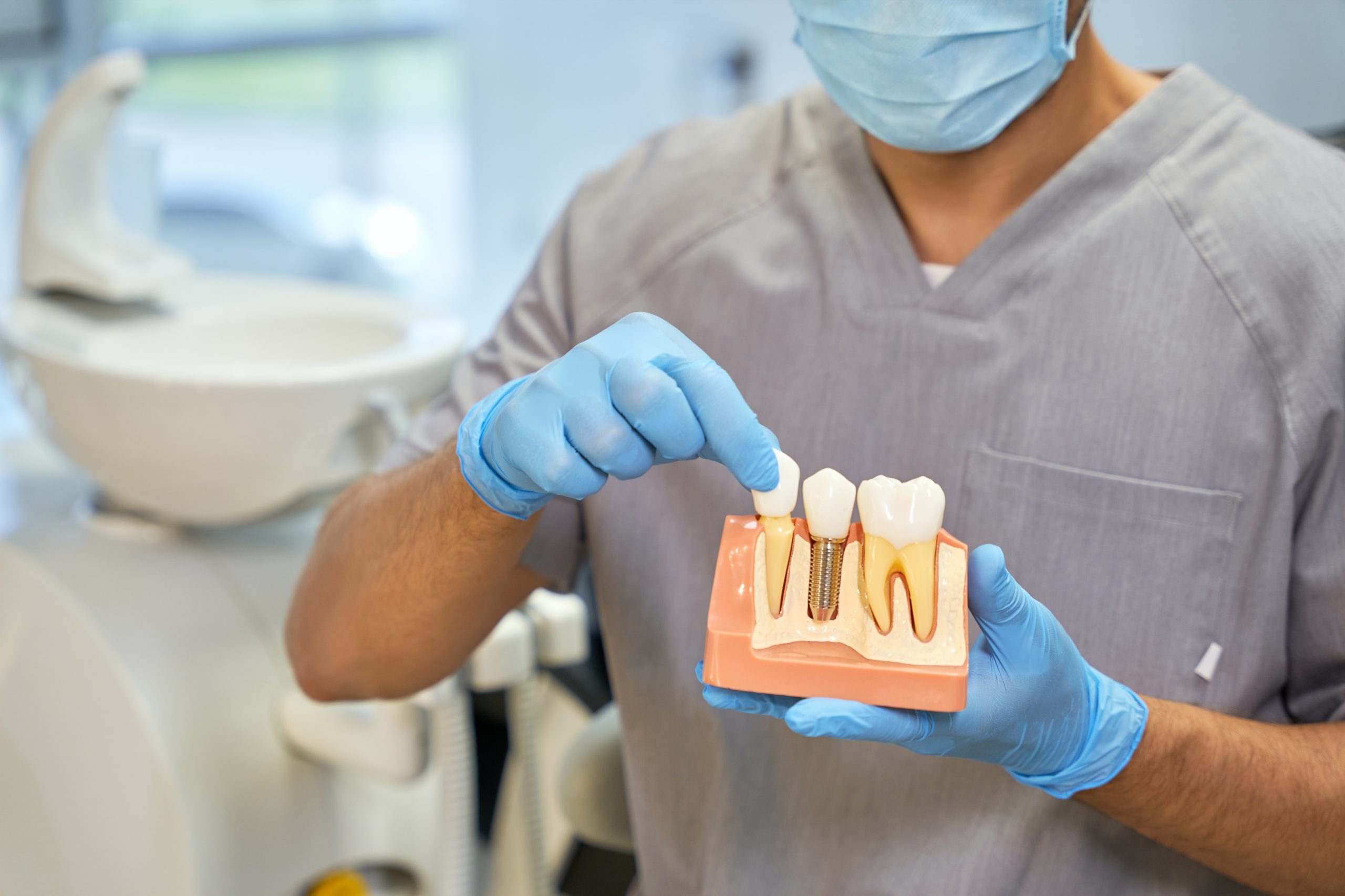 What Are the Pros and Cons of Dental Implants - Golden Gate Dentists