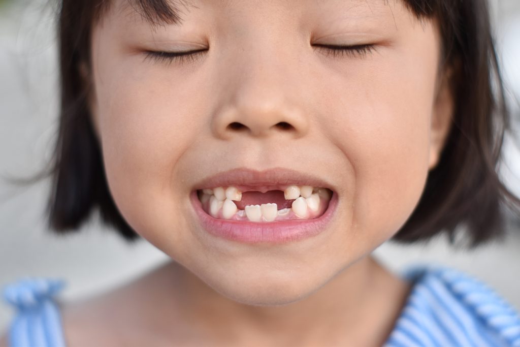 Preventive Pediatric Dental Care - Golden Gate Dentists