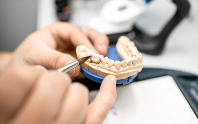 What is Prosthodontics? A Comprehensive Guide to Dental Restoration Techniques