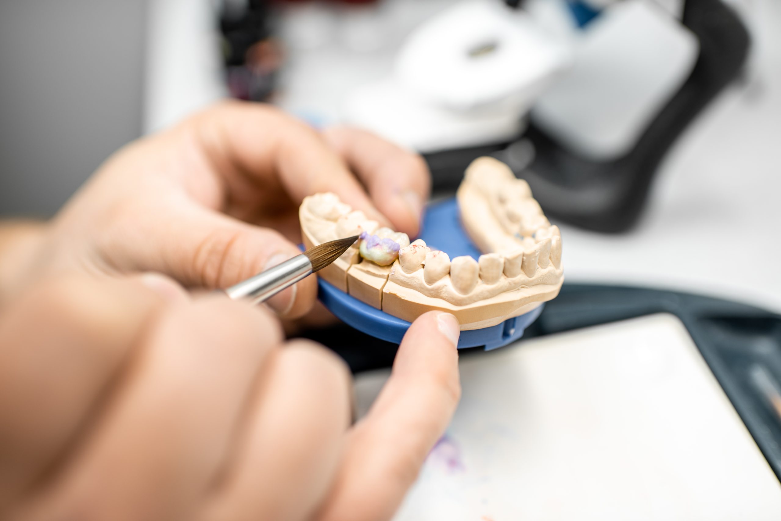 What is Prosthodontics - Golden Gate Dentists