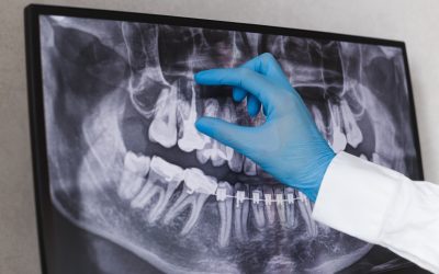 Difference Between a Dentist and an Endodontist: Key Distinctions Explained