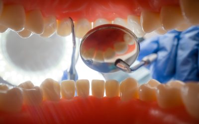Do We Really Need Dentists: Evaluating Their Role in Oral Health